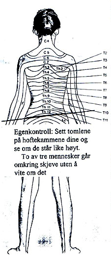 Tykktarmen (colon)