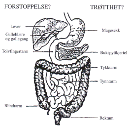 Tykktarmen (colon)